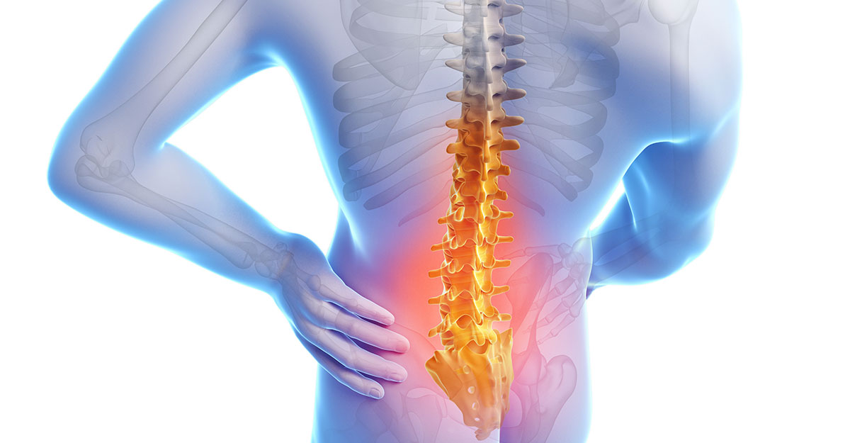 Boardman, OH back pain treatment by Dr. Denise Carradine