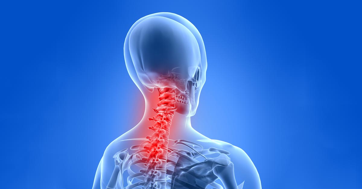 Boardman, OH car accident and neck pain treatment